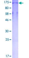 Human ARHGEF2 / GEF-H1 Protein (Recombinant GST)