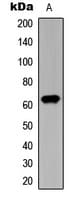 CHEK2 / CHK2 Antibody (phospho-Thr387)