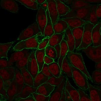 PathPlus™ CTNNB1 / Beta Catenin Antibody (clone rCTNNB1/2173)