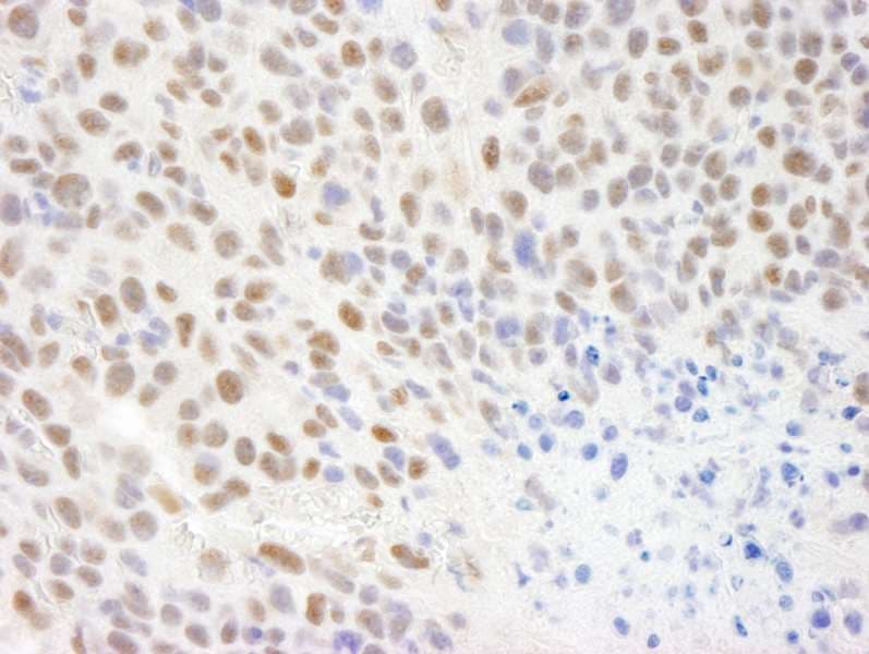 Polyclonal Rabbit anti-Human CMTR1 / FTSJD2 Antibody (aa100-150, IHC)