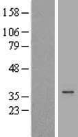 DHRS1 Protein (Over-Expression Lysate Myc-DDK (Flag))