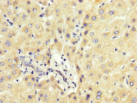 HNRNP-E2 / PCBP2 Antibody