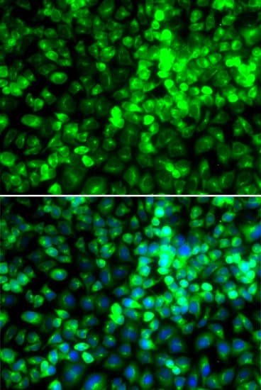 GCN2 Antibody