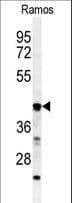 B3GALT6 Antibody (aa241-269)