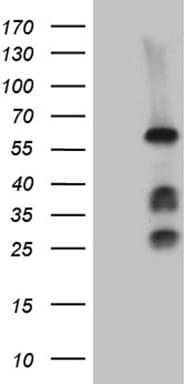 FANCC Antibody (aa1-284, clone OTI11B2, Carrier-free)