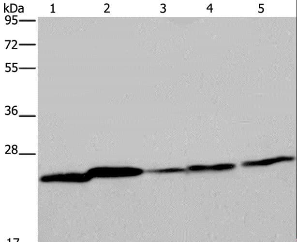 ARHGDIA / RHOGDI Antibody