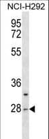 CTRL Antibody (aa72-98)