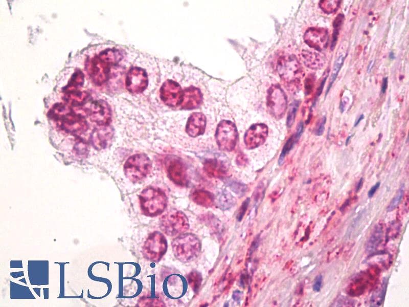 IHC-plus™ Polyclonal Rabbit anti-Human SS18 Antibody (aa1-50, IHC, WB)
