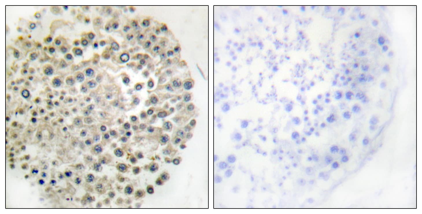 TRIM16 Antibody (aa31-80)