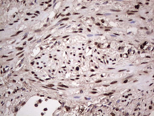 Monoclonal Mouse anti-Human SAE1 Antibody (clone OTI6B11, Carrier-free, IHC, WB)