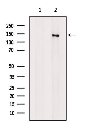 ABCB4 / MDR3 Antibody