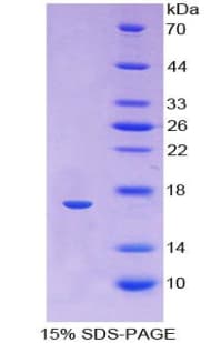 Human HBA1 Protein (Recombinant His)