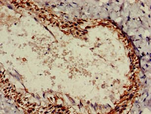 RALDH2 / ALDH1A2 Antibody
