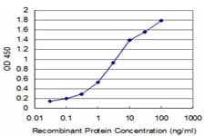 LHX4 Antibody (clone 2F3)