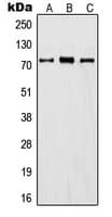 ITIH1 Antibody (Internal)