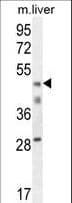 Polyclonal Rabbit anti-Human H2AFY2 Antibody (aa11-39, WB)