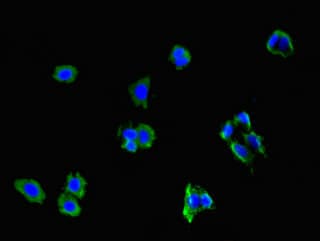 NCMAP / C1orf130 Antibody