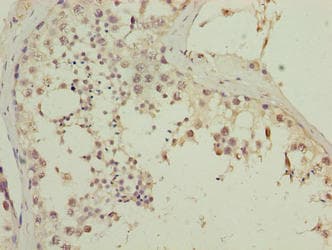 Polyclonal Rabbit anti-Human CGGBP1 Antibody (IHC)