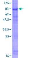 Human FBXL7 Protein (Recombinant GST)