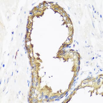 SMAD2 Antibody