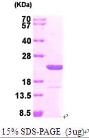 Human MAX Protein (Recombinant His)