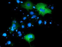 BCAP / PIK3AP1 Antibody (clone OTI5H2)