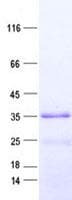 Human EMC10 Protein (Recombinant His, N-Terminal)
