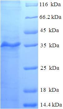 Human MYLPF Protein (Recombinant His-SUMO)