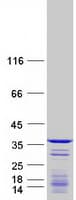 Human CCDC124 Protein (Recombinant Myc-DDK (Flag))