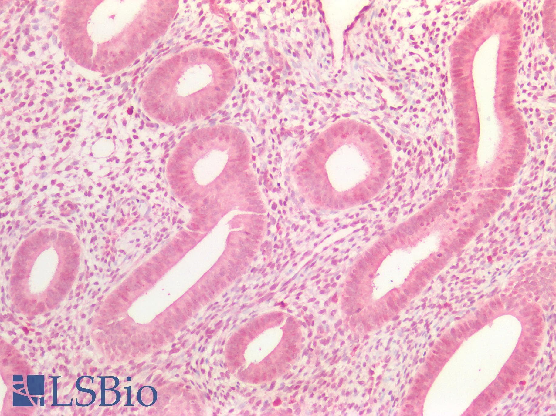 PathPlus™ Polyclonal Rabbit anti-Human IGF2 Antibody (IHC, WB)