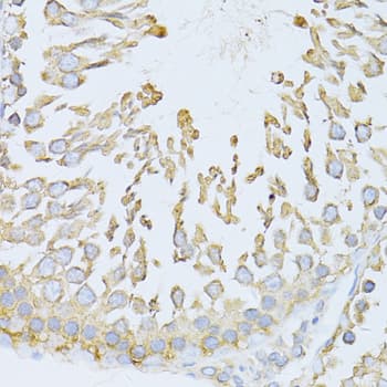 HSPA5 / GRP78 / BiP Antibody