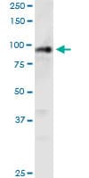 PHC1 / EDR1 Antibody (clone 3G1)