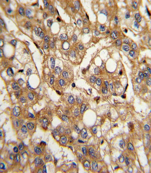 IFN Beta / Interferon Beta Antibody (aa39-66)