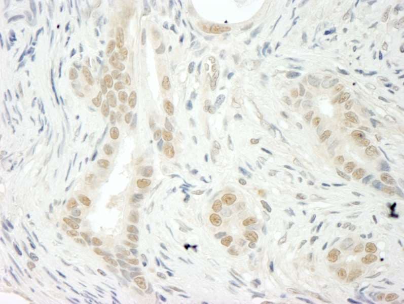 THOC5 Antibody (aa25-75)