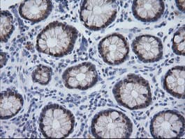 CMPK / CMPK1 Antibody (clone OTI1A9)