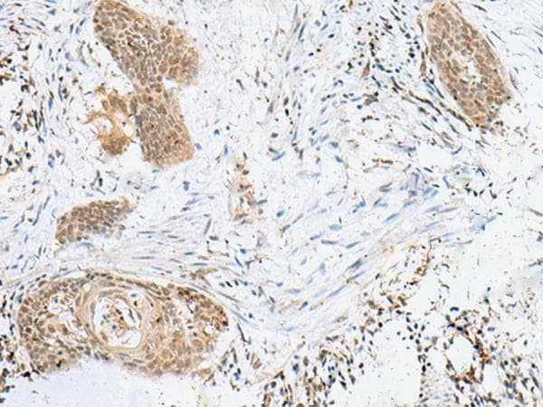 LPXN / Leupaxin Antibody