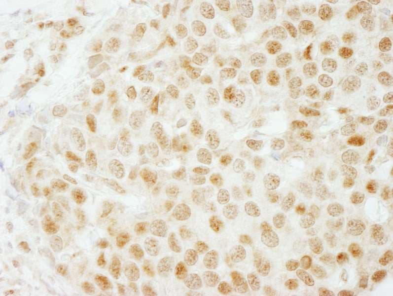 SMARCB1 / INI1 Antibody (aa75-125)