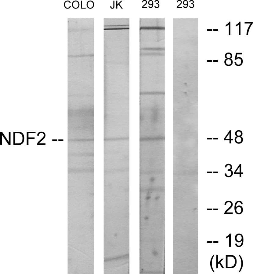 Polyclonal Rabbit anti-Human NEUROD2 Antibody (aa61-110, WB)