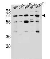 KCNV2 / Kv11.1 Antibody (aa478-507)