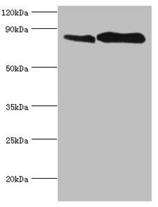IHC-plus™ Polyclonal Rabbit anti-Human CD71 / Transferrin Receptor Antibody (aa 94-754, IHC, IF, WB)