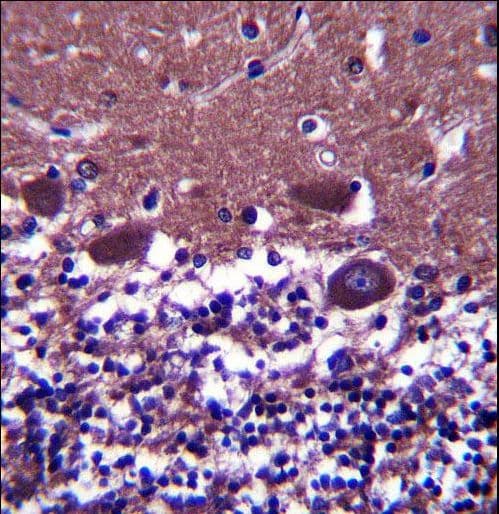 DNAL4 / Dynein Light Chain 4 Antibody (aa1-30)