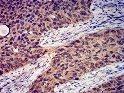 GRIK4 / KA1 Antibody (clone 8H5H9)