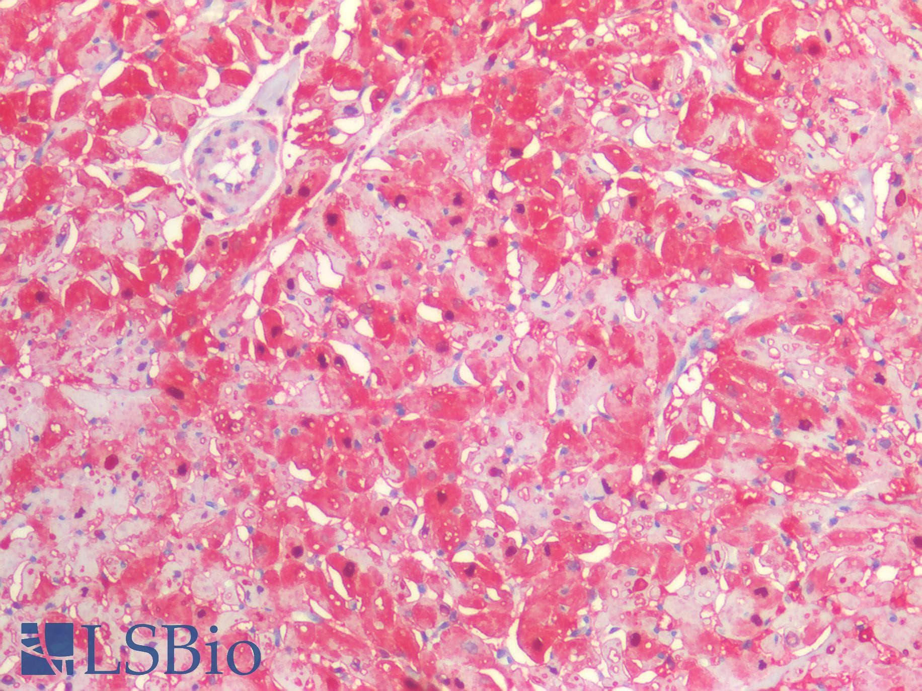 IHC-plus™ Polyclonal Rabbit anti-Human S100A1 / S100-A1 Antibody (N-Terminus, IHC, IF, WB)