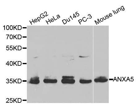 ANXA5 / Annexin V Antibody