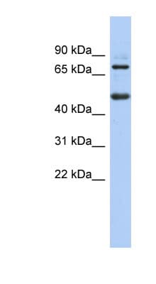 ZBTB26 Antibody (N-Terminus)
