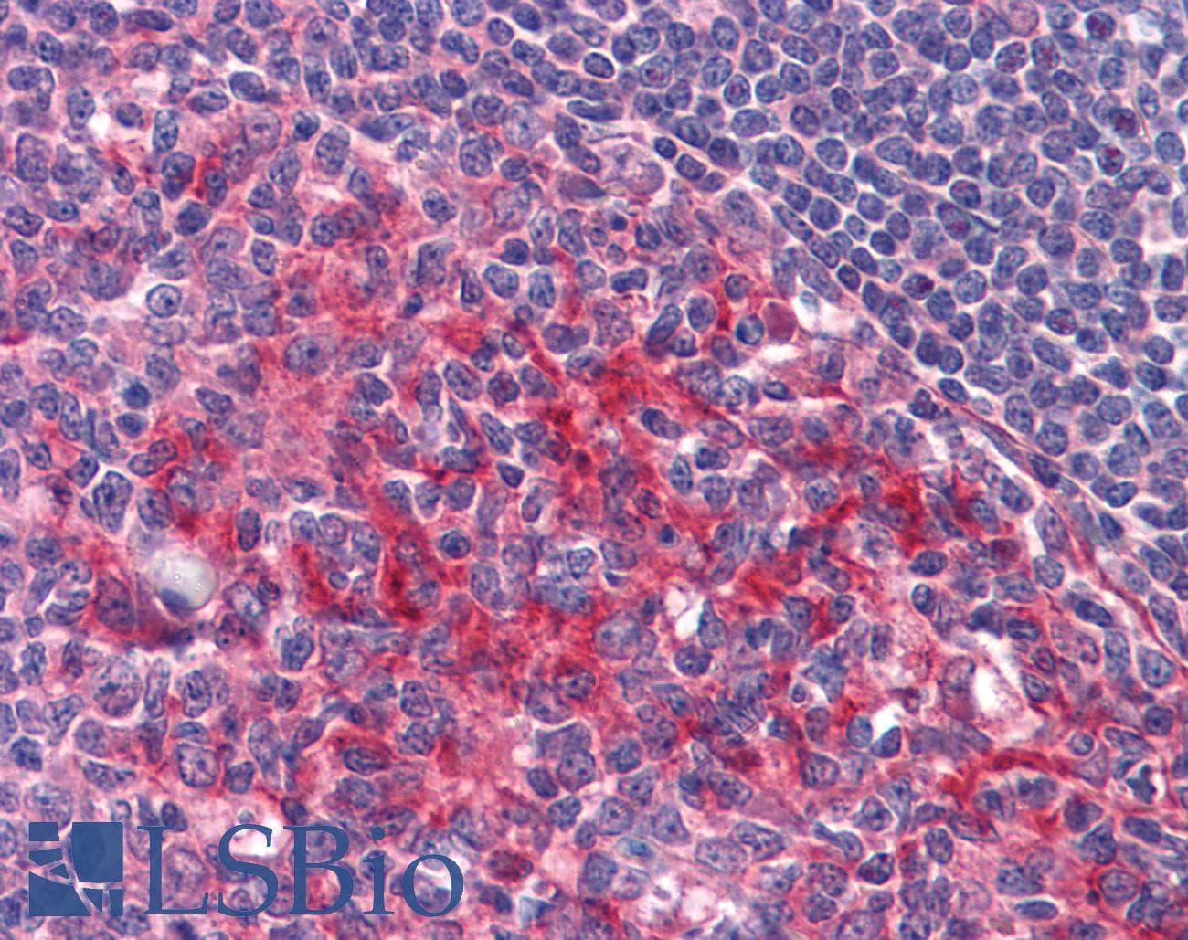 IHC-plus™ Monoclonal Mouse anti-Human FGR Antibody (clone 6G2, IHC, WB)