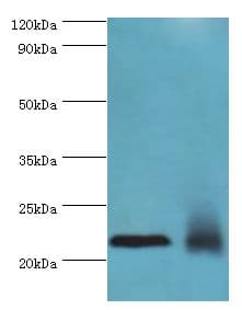 NCS1 / Neuronal Calcium Sensor Antibody (aa1-190)