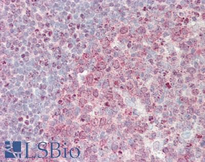 IHC-plus™ CCNH / Cyclin H Antibody (aa262-311)