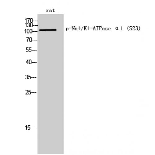 Polyclonal Rabbit anti-Rat ATP1A1 Antibody (phospho-Ser16, IF, WB)