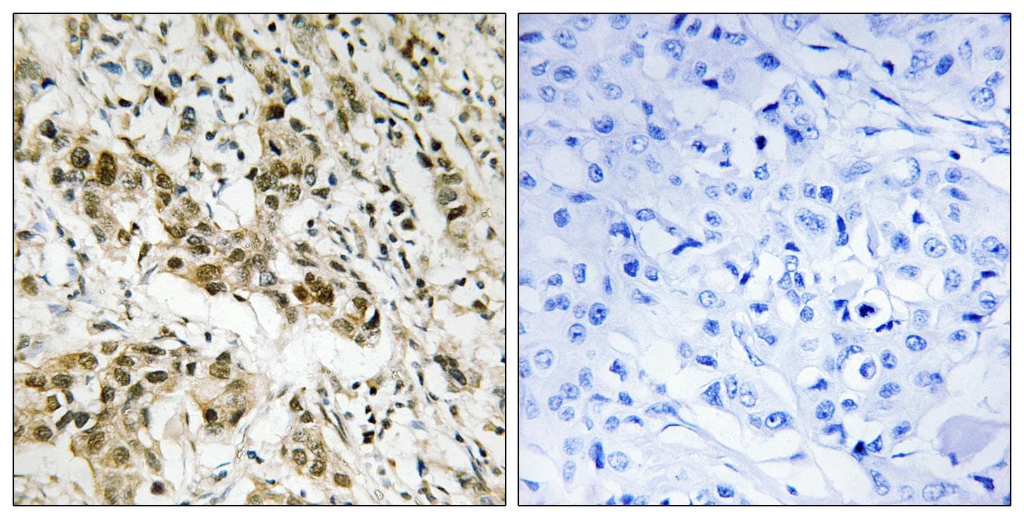 Polyclonal Rabbit anti-Human CTBP1 / CTBP Antibody (p422, IHC, WB)